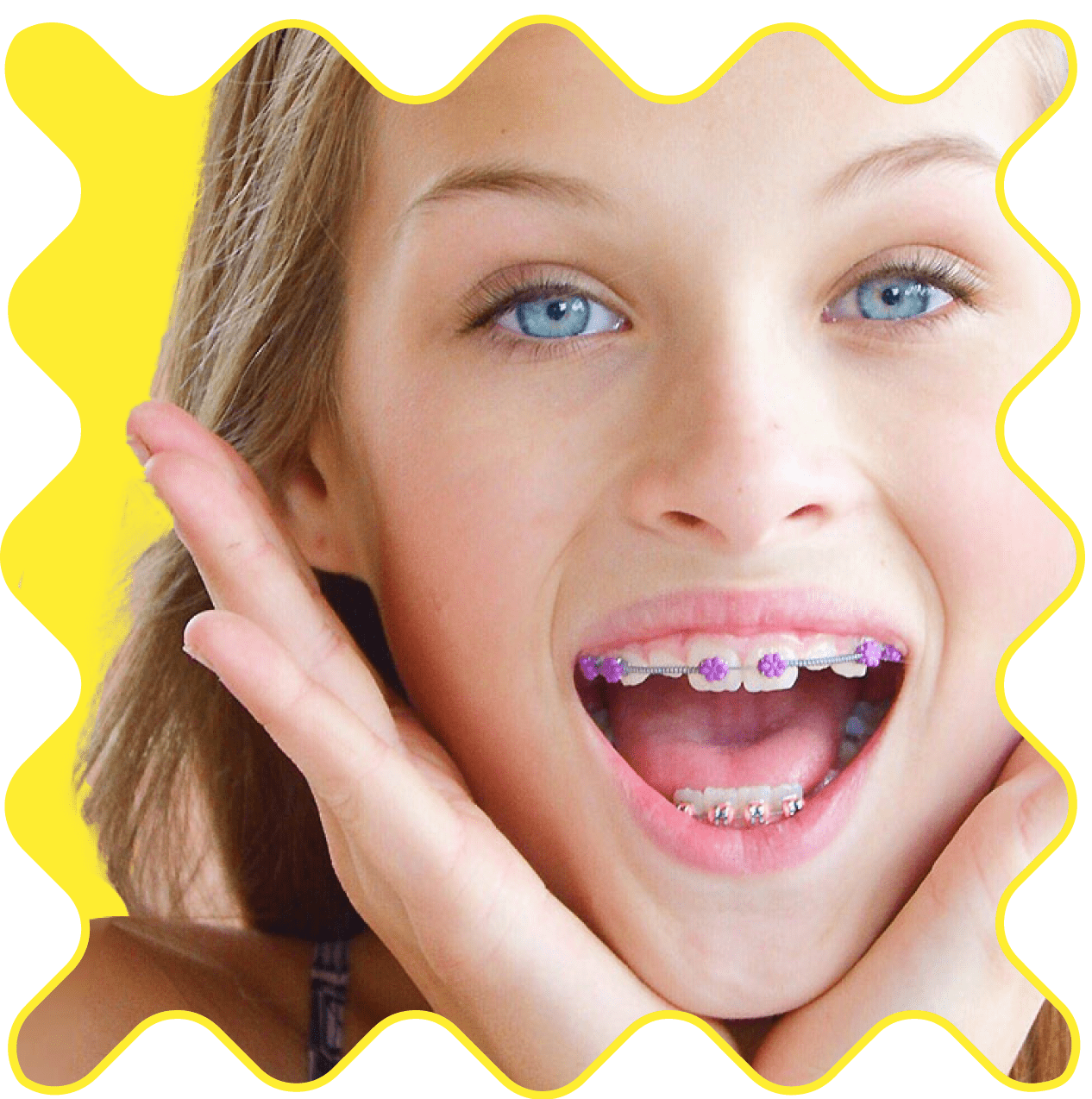 Girl With DesignerTies On Her Braces.